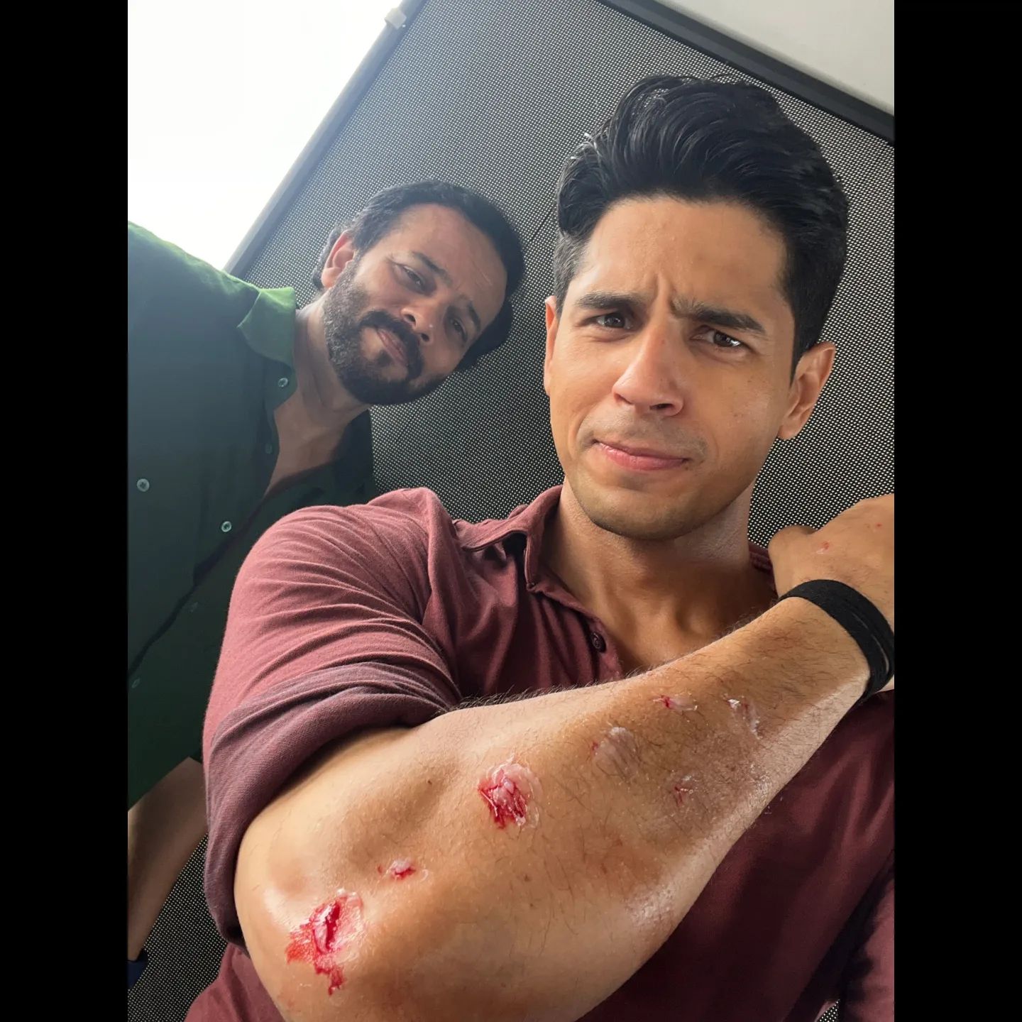 Sidharth Malhotra gets bruises while filming