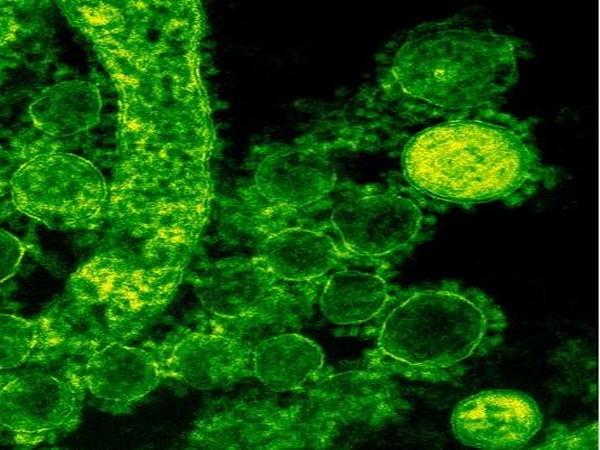 New coronavirus antibody detection method