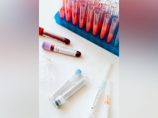 Blood serum test detect neurodegenerative disorder