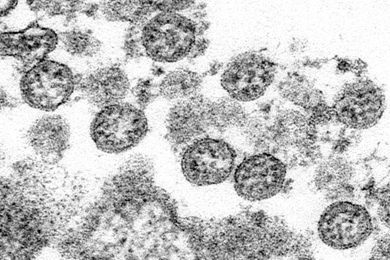 COVID-19 infections rise, Delta variant spreads to 132 countries: WHO