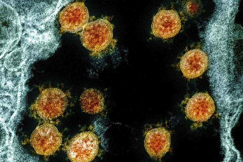 228 new cases of coronavirus reported on Friday