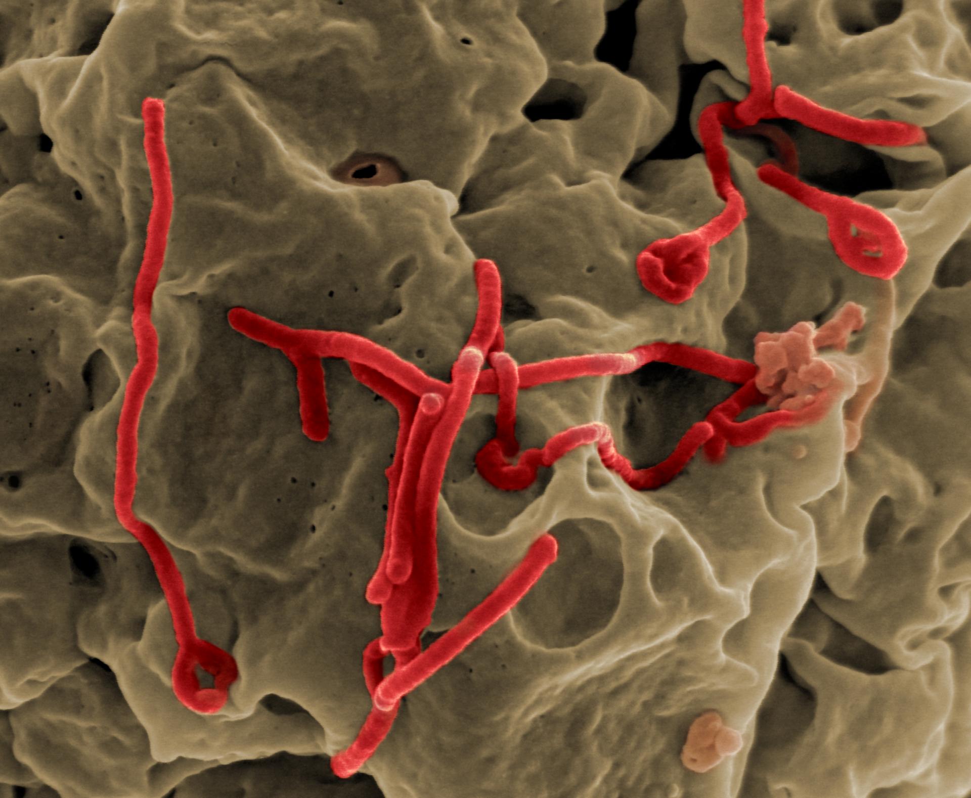 Ebola infects 28 people, kills 11 in Guinea