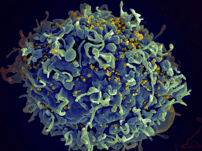 UN urges action to end AIDS, says COVID-19 hurt progress