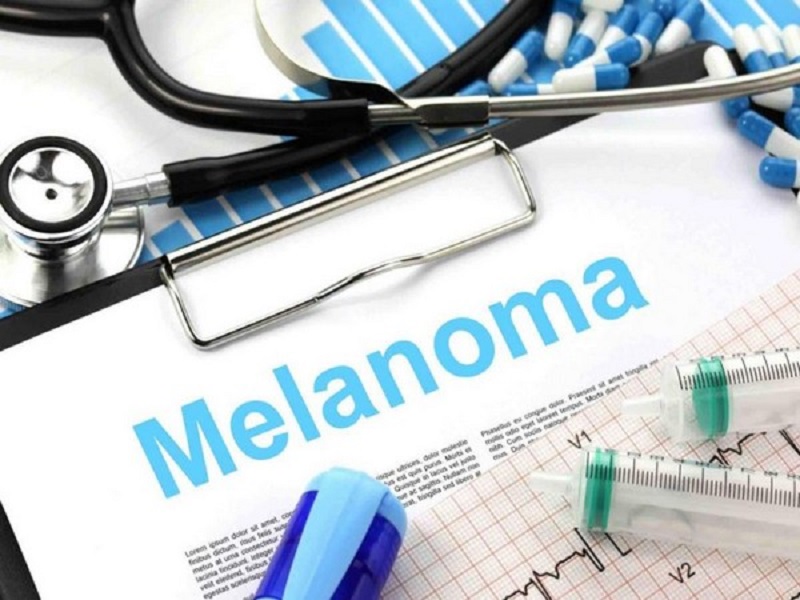 Melanoma patients benefit from immunotherapy drug: Study