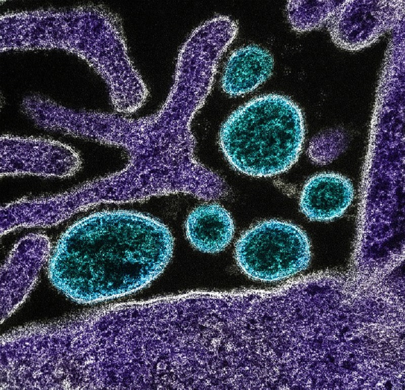 India’s Kerala state reports Nipah virus death
