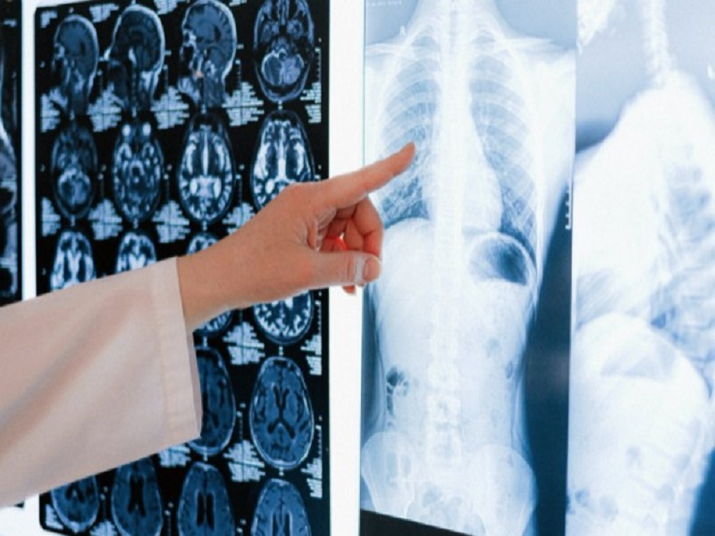 Study for better understanding of cystic fibrosis