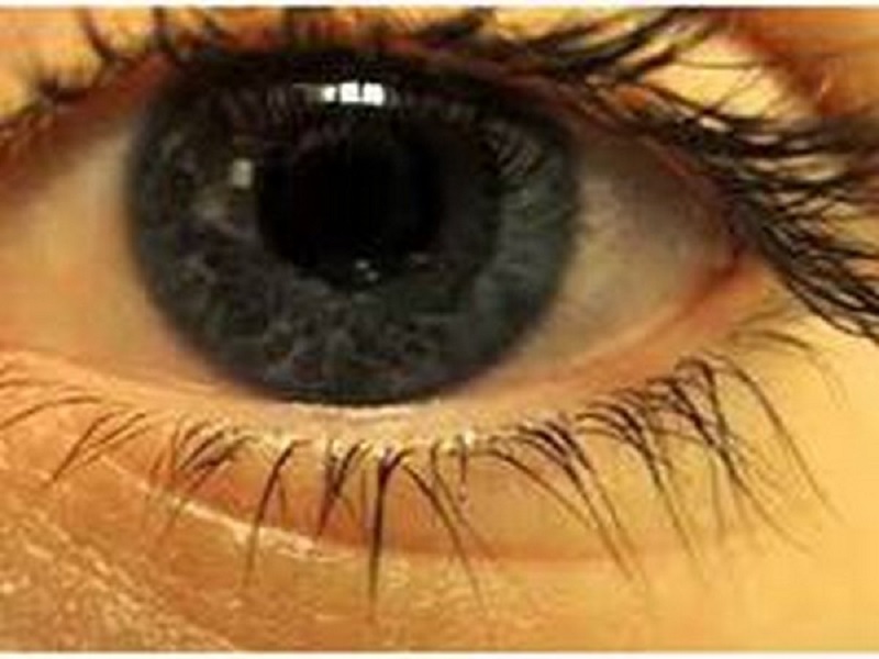 Clinically significant cataract associated with increased risk of death from vascular causes: Study