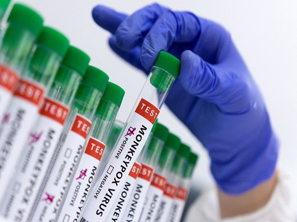 US declares Monkeypox outbreak a Public Health Emergency
