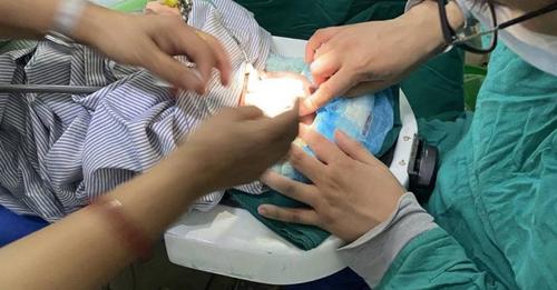 Historic leap in eye treatment: Lens sparing vitrectomy of 29 week-old baby successful