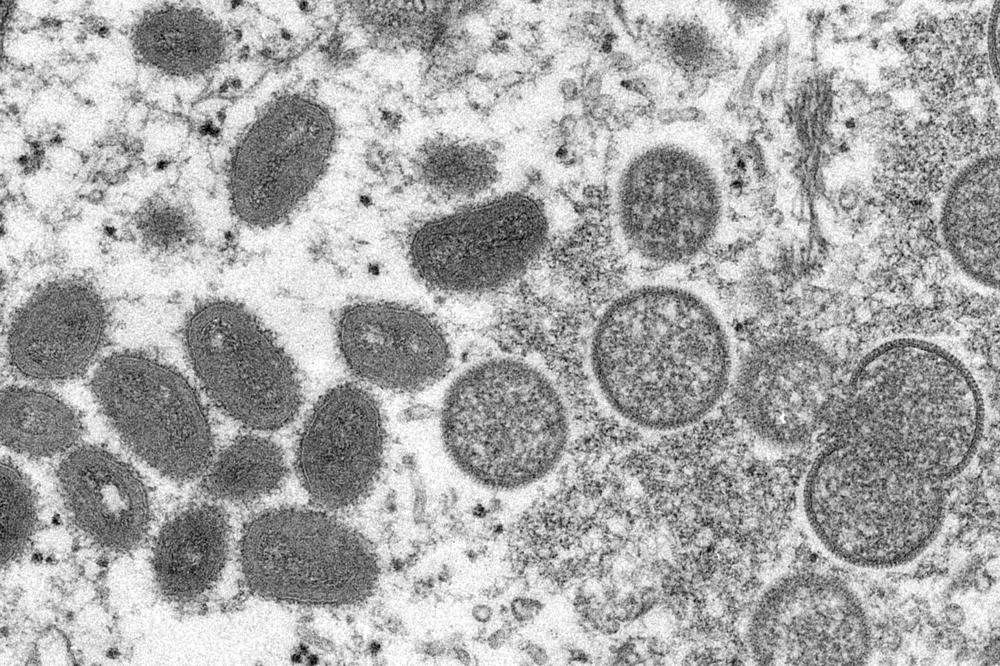 Thailand to administer monkeypox vaccines
