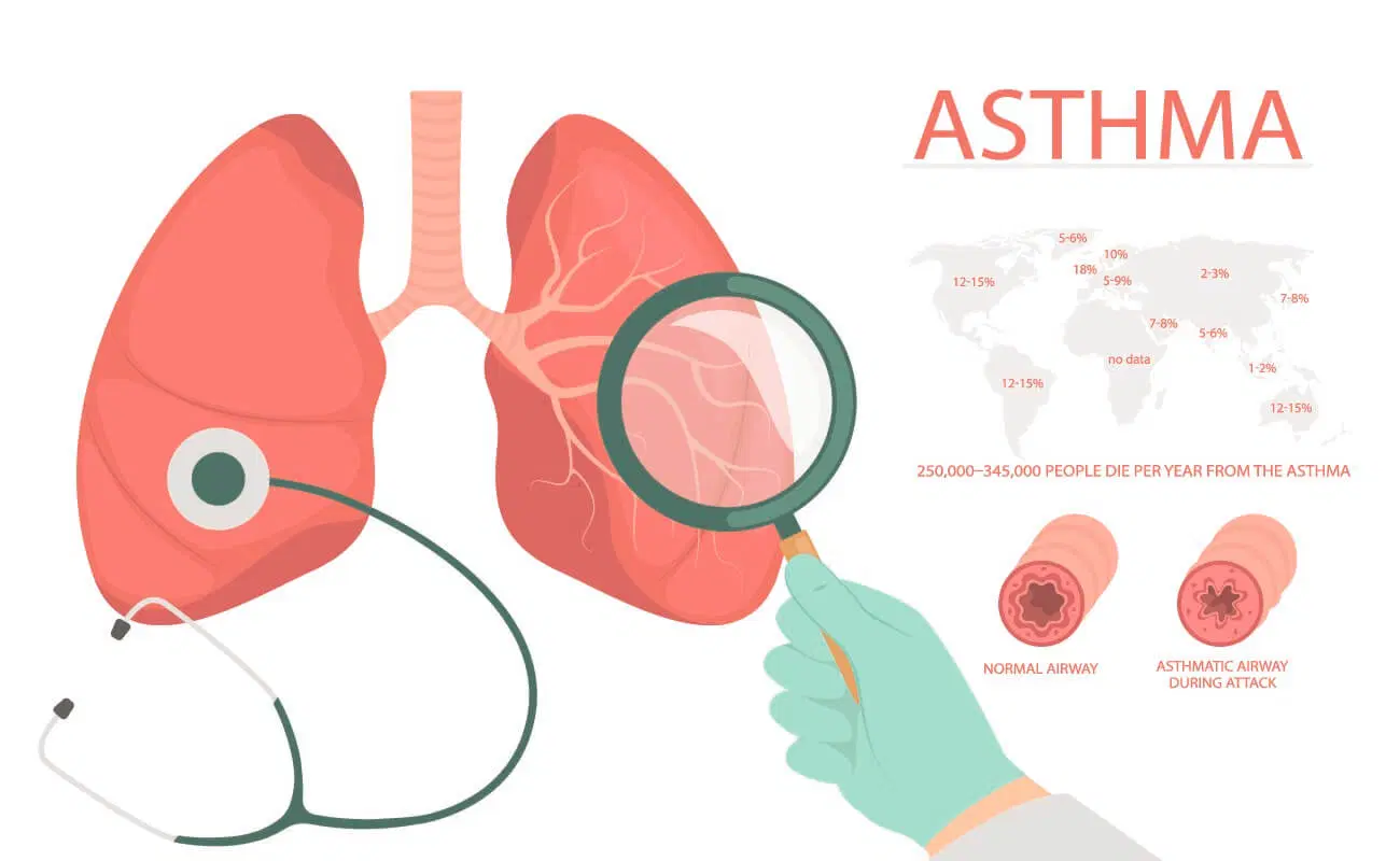 Asthma Triggers: What You Need to Know to Stay Safe