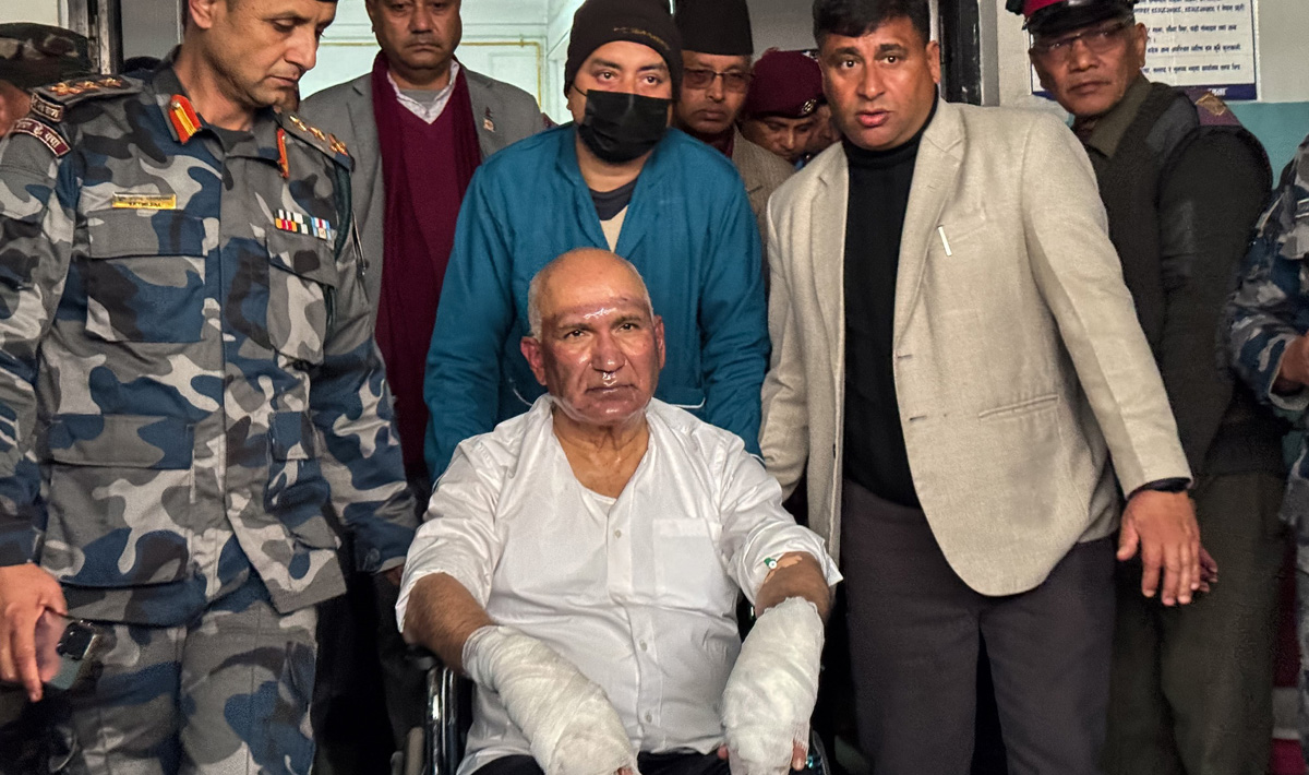 Finance Minister Paudel discharged from hospital after balloon explosion injury