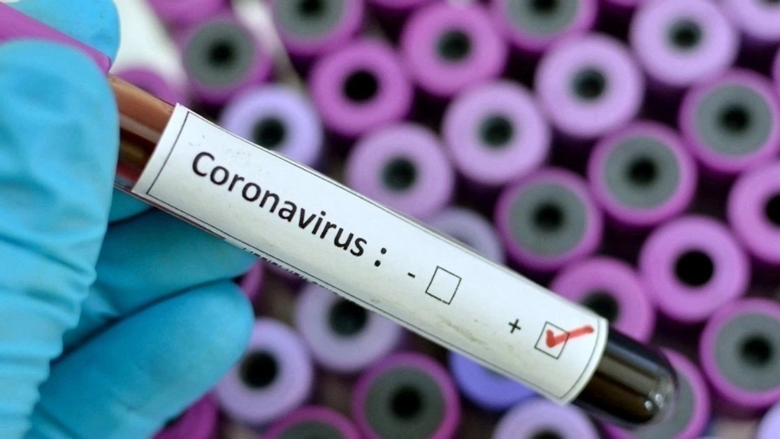 Three covid cases detected among India returnees in Sudurpaschim