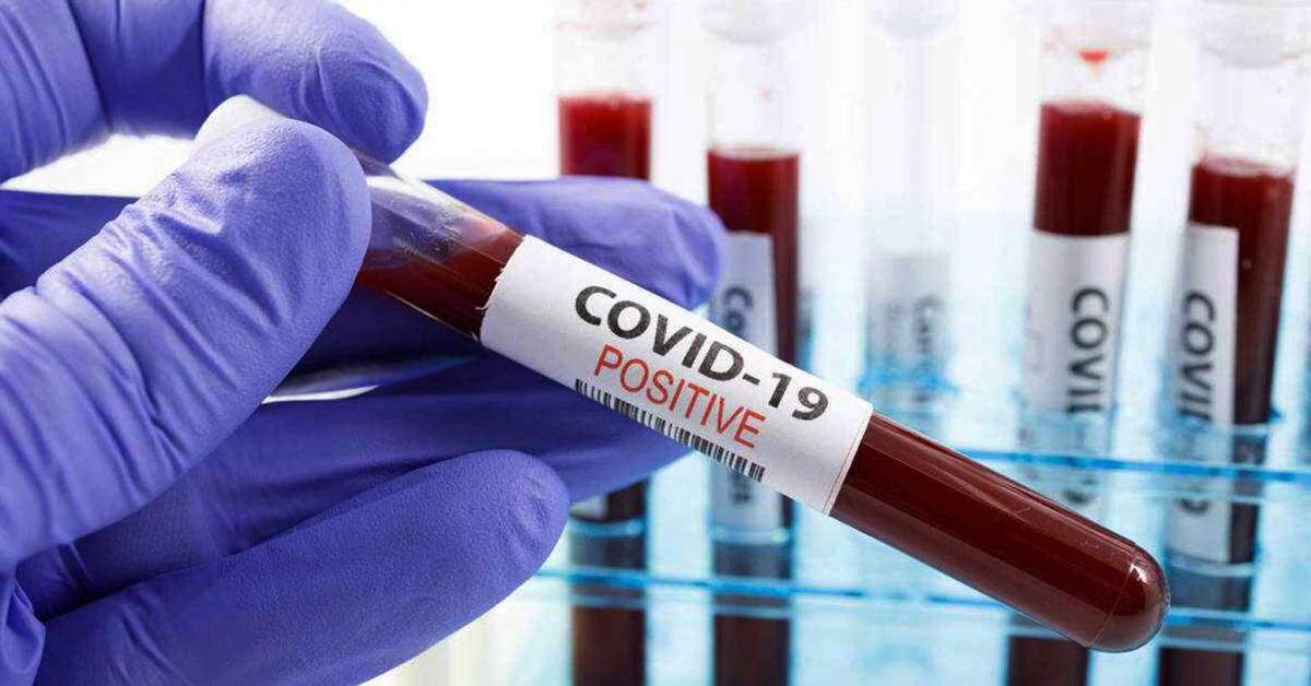 Jhapa reports eight new cases of Covid-19