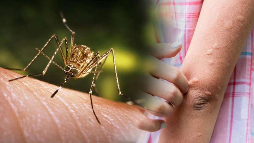 6 people die from Japanese encephalitis in Chitwan