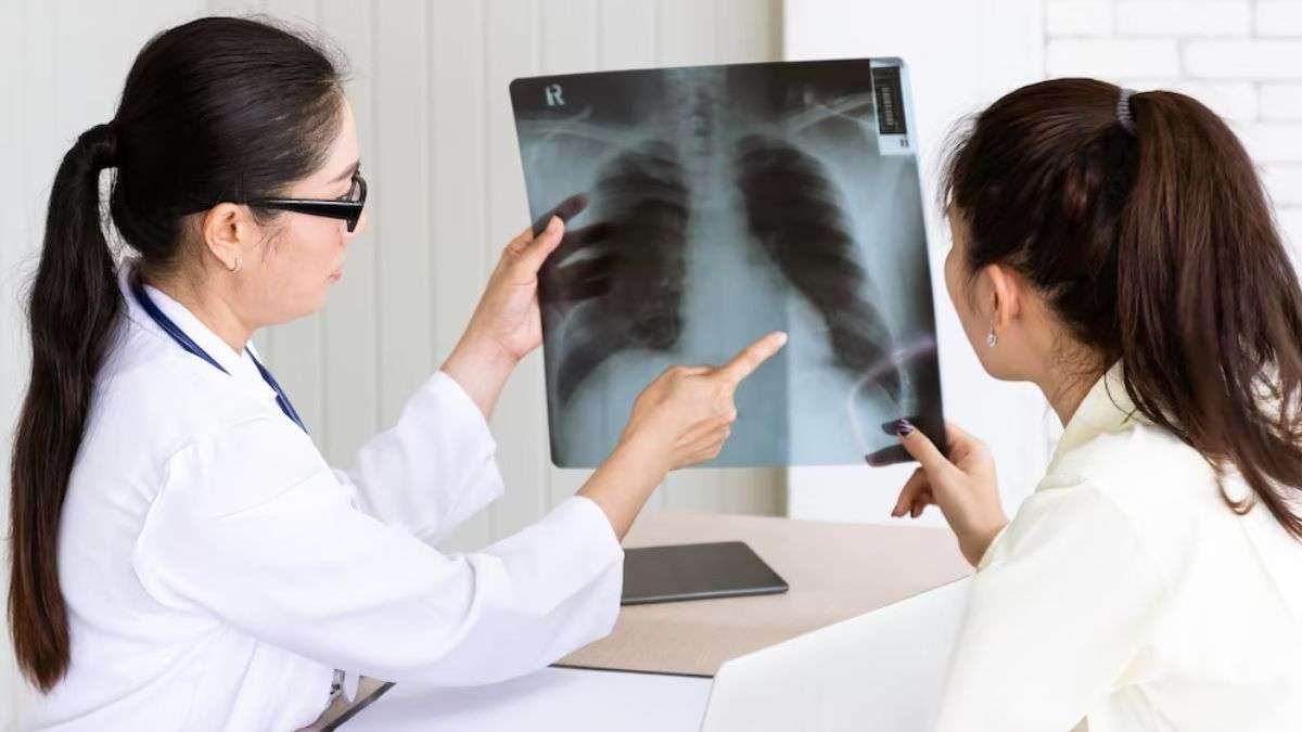 World TB Day being marked today