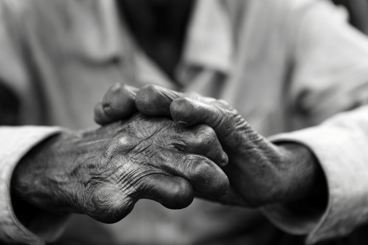18 people diagnosed with leprosy in Chitwan