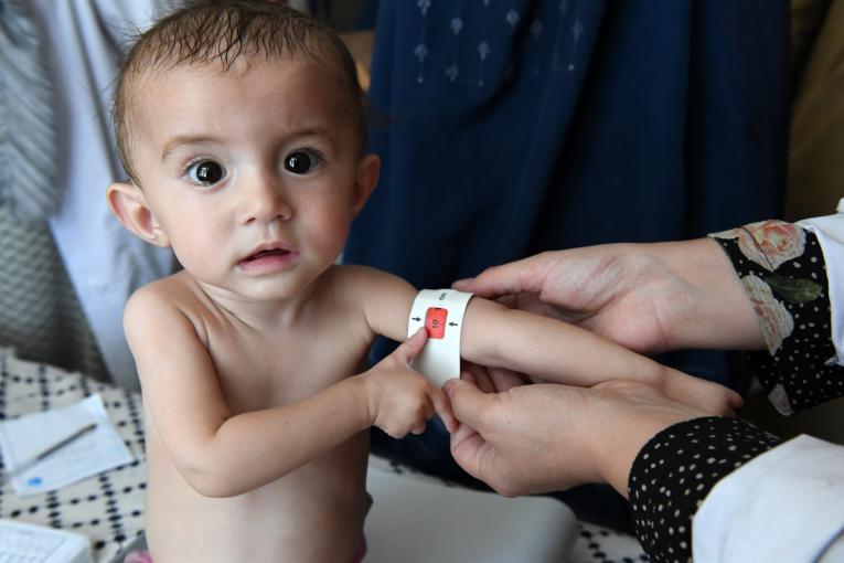 Eighteen thousand children diagnosed with severe acute malnutrition