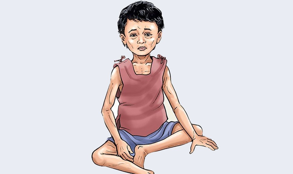 16 percent of children are malnourished in Madhesh
